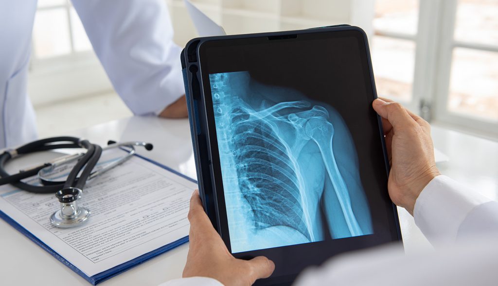 Digital X-ray orthopaedic imaging at Bafna Clinic Borivali Mumbai
