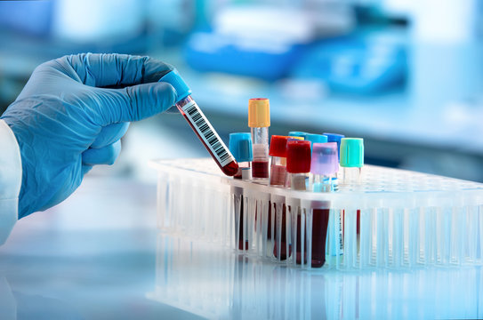 Orthopaedic laboratory and blood test investigations at Bafna Clinic Mumbai