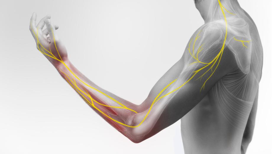 Nerve pain and sciatica treatment at Bafna Clinic Mumbai