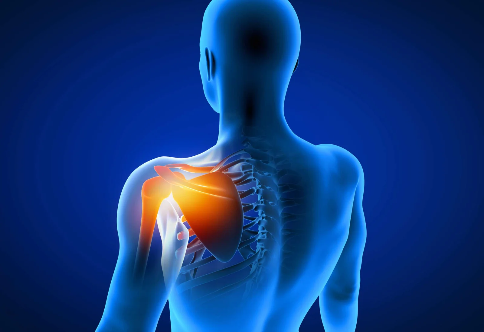 Shoulder Replacement